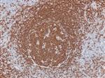 3050B | Control Slides:Immunopathology; CD20, B-Cell